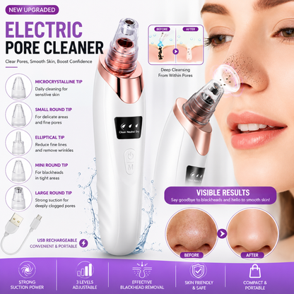 Electric Blackhead Remover Vacuum | USB Rechargeable Face Pore Cleaner with 4 Suction Heads