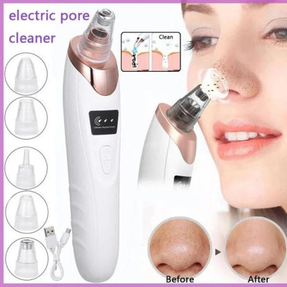 Electric Blackhead Remover Vacuum | USB Rechargeable Face Pore Cleaner with 4 Suction Heads